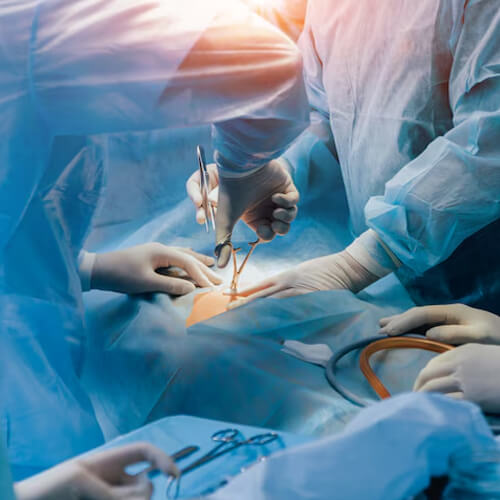 General Surgery at Panacea Hospital, Ranchi offers the best surgical care with top surgeons, advanced procedures, and affordable services in Jharkhand.