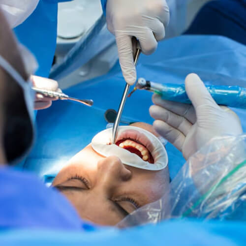 Oral & Maxillofacial Surgery at Panacea Hospital, Ranchi offers the best facial surgery with top surgeons, advanced procedures, and affordable services in Jharkhand.